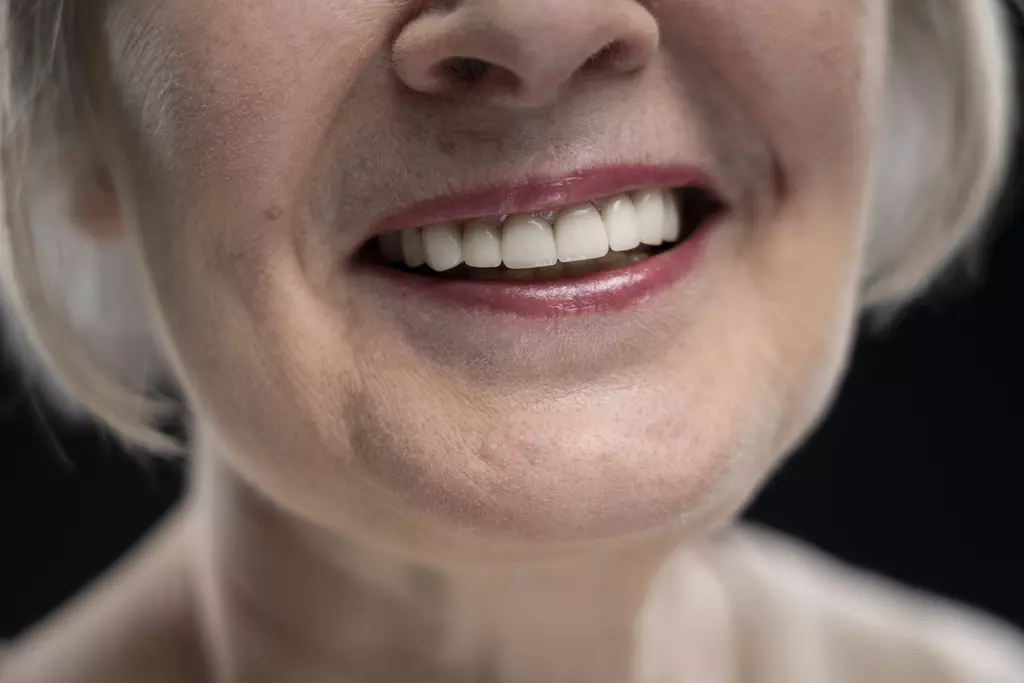 lic&oacute;wki Zakopane,Korony zębowe Zakopane,Korony zębowe i lic&oacute;wki Zakopane